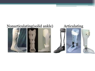 Nonarticulating(solid ankle) Articulating
 