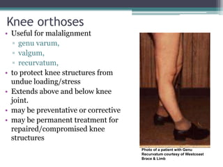 Knee orthoses
• Useful for malalignment
▫ genu varum,
▫ valgum,
▫ recurvatum,
• to protect knee structures from
undue loading/stress
• Extends above and below knee
joint.
• may be preventative or corrective
• may be permanent treatment for
repaired/compromised knee
structures
Photo of a patient with Genu
Recurvatum courtesy of Westcoast
Brace & Limb
 