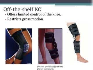 Off-the–shelf KO
• Offers limited control of the knee.
• Restricts gross motion
Dynamic Extension assist KO to
prevent contractures
 