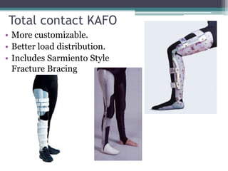 Total contact KAFO
• More customizable.
• Better load distribution.
• Includes Sarmiento Style
Fracture Bracing
 