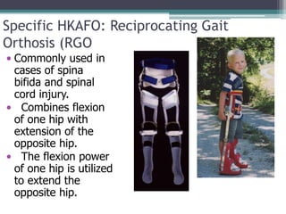 Specific HKAFO: Reciprocating Gait
Orthosis (RGO
• Commonly used in
cases of spina
bifida and spinal
cord injury.
• Combines flexion
of one hip with
extension of the
opposite hip.
• The flexion power
of one hip is utilized
to extend the
opposite hip.
 