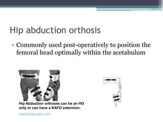 Hip abduction orthosis
• Commonly used post-operatively to position the
femoral head optimally within the acetabulum
Hip Abduction orthoses can be an HO
only or can have a KAFO extension.
www.pelsupply.com
 