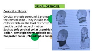 Cervical autosis surround
SPINAL ORTHOSIS
Cervical orthosis
Cervical orthosis surround & protect
the cervical spine . They include the
collars which are the least restrictive and
provide partial range of motion .
Such as soft cervical collar , semirigid
collar , semirigid thermoplastic collar ,
2/4 poster collar , Philadelphia collar.
 