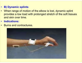 Orthosis 9. UE Orthosis.pdf orthosis of upper limb | PDF