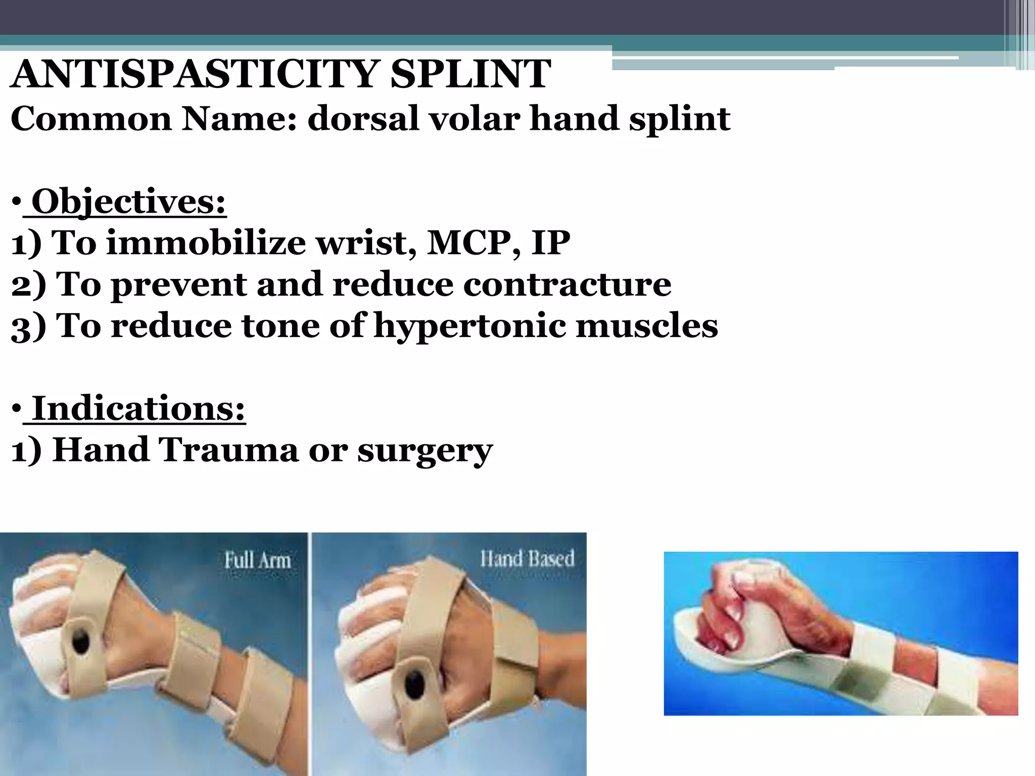 ANTISPASTICITY SPLINT
Common Name: dorsal volar hand splint
• Objectives:
1) To immobilize wrist, MCP, IP
2) To prevent and reduce contracture
3) To reduce tone of hypertonic muscles
• Indications:
1) Hand Trauma or surgery
 