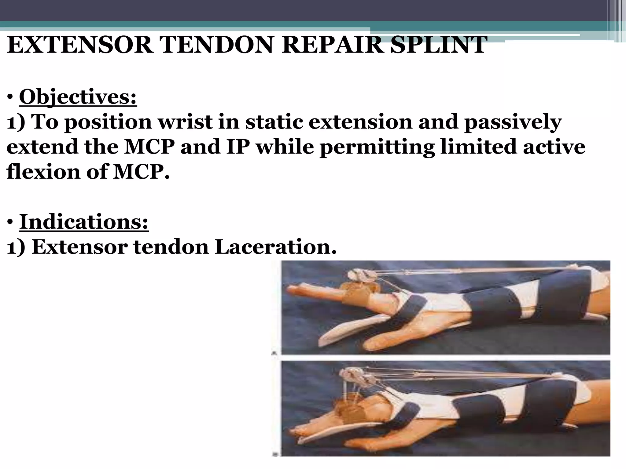 EXTENSOR TENDON REPAIR SPLINT
• Objectives:
1) To position wrist in static extension and passively
extend the MCP and IP while permitting limited active
flexion of MCP.
• Indications:
1) Extensor tendon Laceration.
 