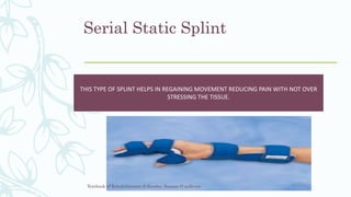 Dynamic Serial Splint Orthosis PPT | PPTX