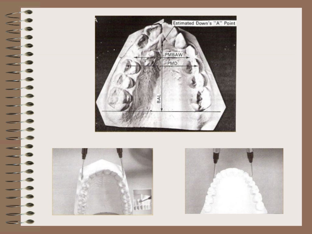 Orthodontic Study Model Analysis