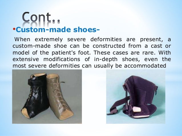 custom made diabetic shoes
