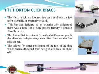THE HORTON CLICK BRACE
 The Horton click is a foot rotation bar that allows the feet
to be internally or externally rotated.
 This bar was designed by an orthotist who understood
there was a need for a more patient friendly / orthotist
friendly device.
 TheHortonClick is easier to fit on the child because you fit
the shoes on independently then click them on the foot
rotation bar.
 This allows for better positioning of the foot in the shoe
which reduces the child from being able to kick the shoes
off.
Aratatran Patra
11.02.2022
 