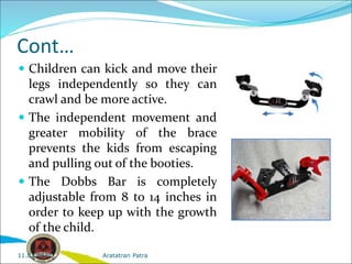 Cont…
 Children can kick and move their
legs independently so they can
crawl and be more active.
 The independent movement and
greater mobility of the brace
prevents the kids from escaping
and pulling out of the booties.
 The Dobbs Bar is completely
adjustable from 8 to 14 inches in
order to keep up with the growth
of the child.
Aratatran Patra
11.02.2022
 
