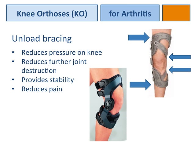Orthotic management of knee pain | PPTX