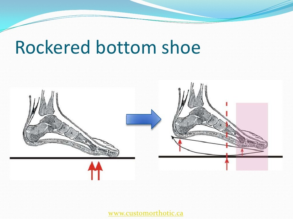 Diabetic Foot and Orthotic Management