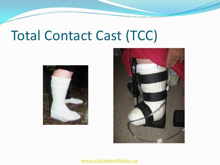 Diabetic Foot and Orthotic Management