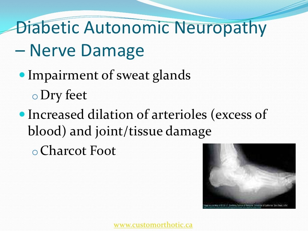 Diabetic Foot and Orthotic Management