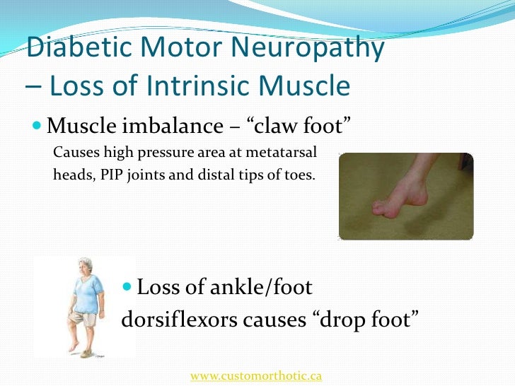 Diabetic Foot and Orthotic Management