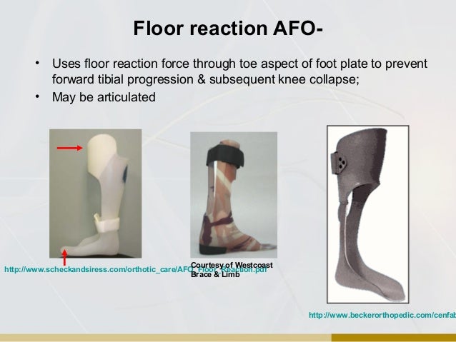Orthotic Overview