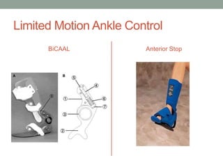 Limited Motion Ankle Control
      BiCAAL            Anterior Stop
 