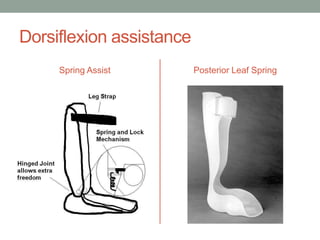 Dorsiflexion assistance
     Spring Assist        Posterior Leaf Spring
 