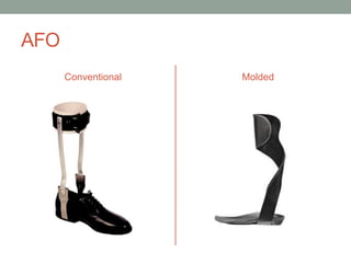 AFO
      Conventional   Molded
 