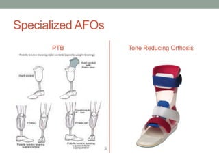 Specialized AFOs
      PTB          Tone Reducing Orthosis
 