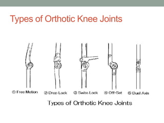 Types of Orthotic Knee Joints
 