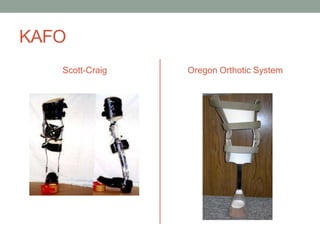 KAFO
   Scott-Craig   Oregon Orthotic System
 