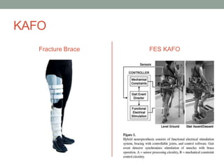 KAFO
   Fracture Brace   FES KAFO
 