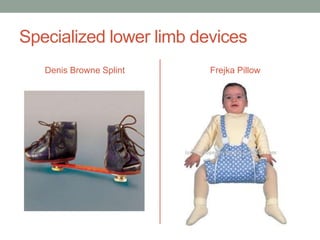 Specialized lower limb devices
   Denis Browne Splint   Frejka Pillow
 