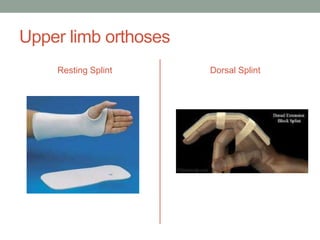Upper limb orthoses
    Resting Splint    Dorsal Splint
 