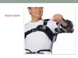 Airplane Splint
 