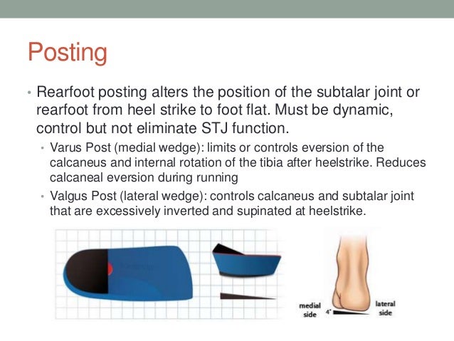 Running Shoes Lateral Wedge Running Shoes Lateral Wedge