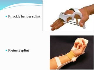 Orthotics | PPTX