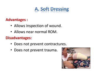 Advantages :
• Allows inspection of wound.
• Allows near normal ROM.
Disadvantages:
• Does not prevent contractures.
• Does not prevent trauma.
 
