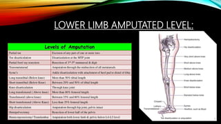 LOWER LIMB AMPUTATED LEVEL:
 