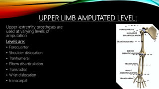 UPPER LIMB AMPUTATED LEVEL:
Upper-extremity prostheses are
used at varying levels of
amputation
Levels are:
• Forequarter
• Shoulder dislocation
• Tranhumeral
• Elbow disarticulation
• Transradial
• Wrist dislocation
• transcarpal
 