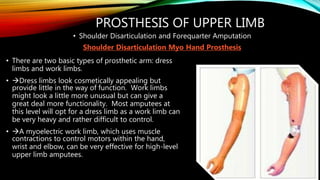 PROSTHESIS OF UPPER LIMB
• Shoulder Disarticulation and Forequarter Amputation
Shoulder Disarticulation Myo Hand Prosthesis
• There are two basic types of prosthetic arm: dress
limbs and work limbs.
• Dress limbs look cosmetically appealing but
provide little in the way of function. Work limbs
might look a little more unusual but can give a
great deal more functionality. Most amputees at
this level will opt for a dress limb as a work limb can
be very heavy and rather difficult to control.
• A myoelectric work limb, which uses muscle
contractions to control motors within the hand,
wrist and elbow, can be very effective for high-level
upper limb amputees.
 