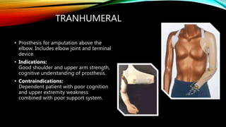 TRANHUMERAL
• Prosthesis for amputation above the
elbow. Includes elbow joint and terminal
device.
• Indications:
Good shoulder and upper arm strength,
cognitive understanding of prosthesis.
• Contraindications:
Dependent patient with poor cognition
and upper extremity weakness
combined with poor support system.
 