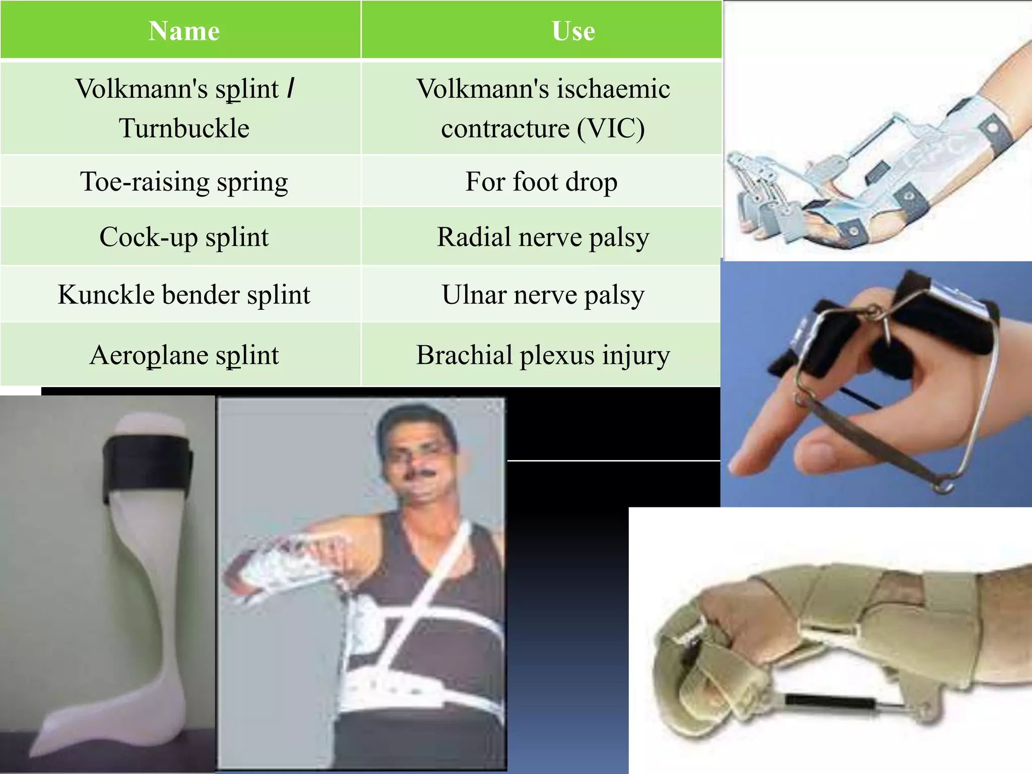 Name                        Use

 Volkmann's splint I    Volkmann's ischaemic
    Turnbuckle            contracture (VIC)
 Toe-raising spring         For foot drop
   Cock-up splint        Radial nerve palsy

Kunckle bender splint     Ulnar nerve palsy

  Aeroplane splint      Brachial plexus injury
 