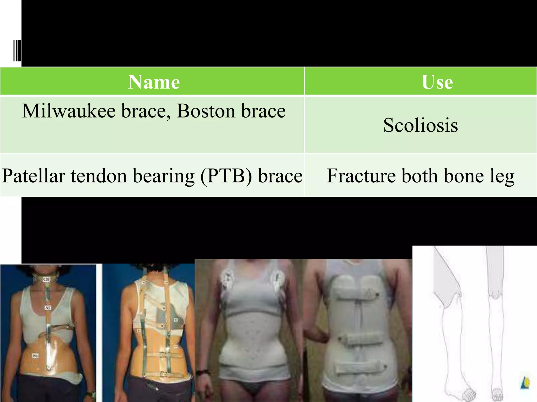 Name                                Use
  Milwaukee brace, Boston brace
                                            Scoliosis

Patellar tendon bearing (PTB) brace   Fracture both bone leg
 