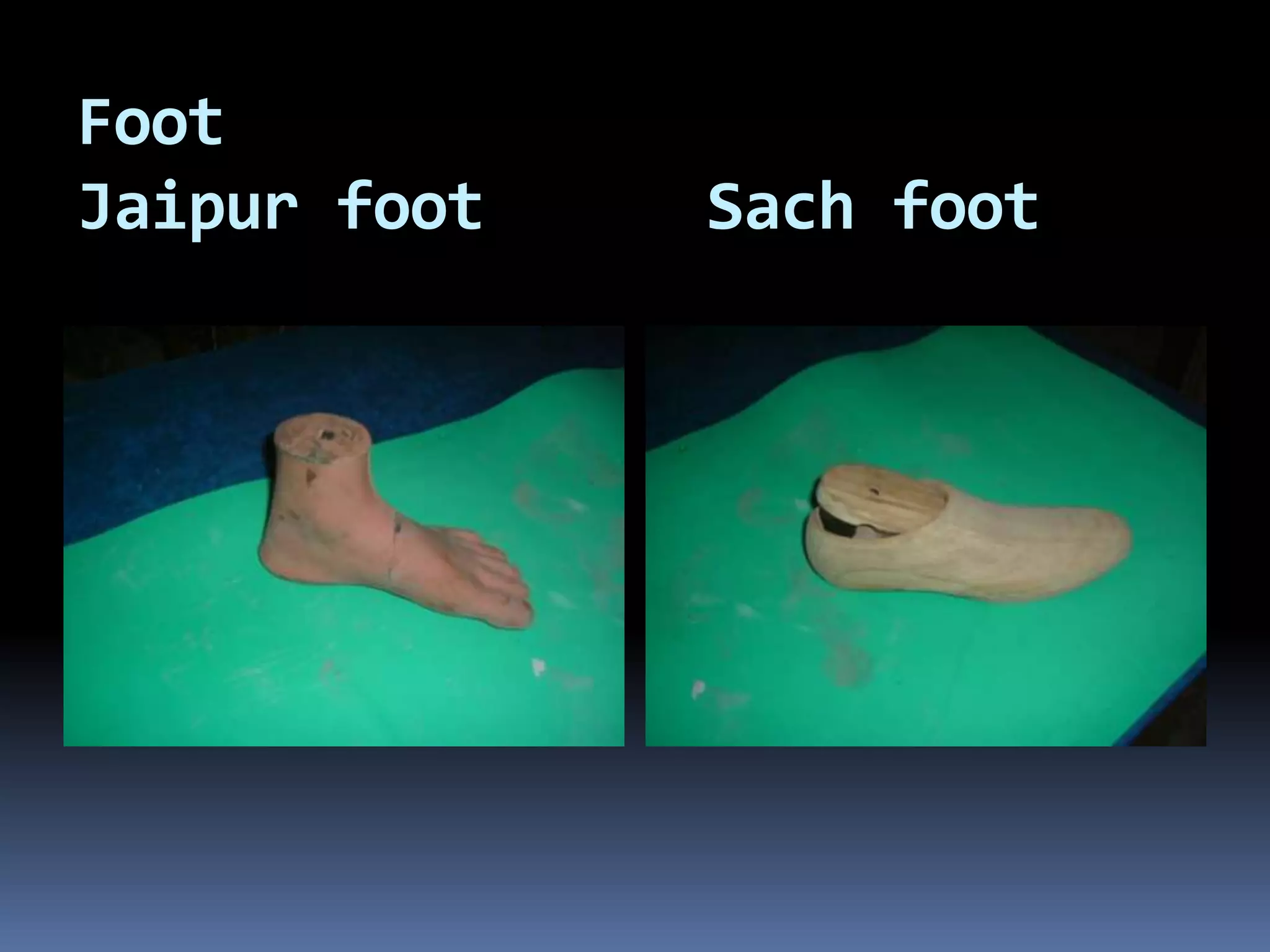 Foot
Jaipur foot   Sach foot
 