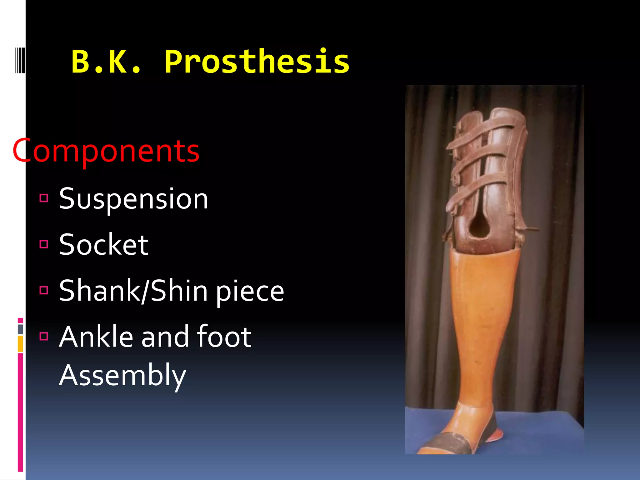 B.K. Prosthesis

Components
  Suspension
  Socket
  Shank/Shin piece
  Ankle and foot
  Assembly
 