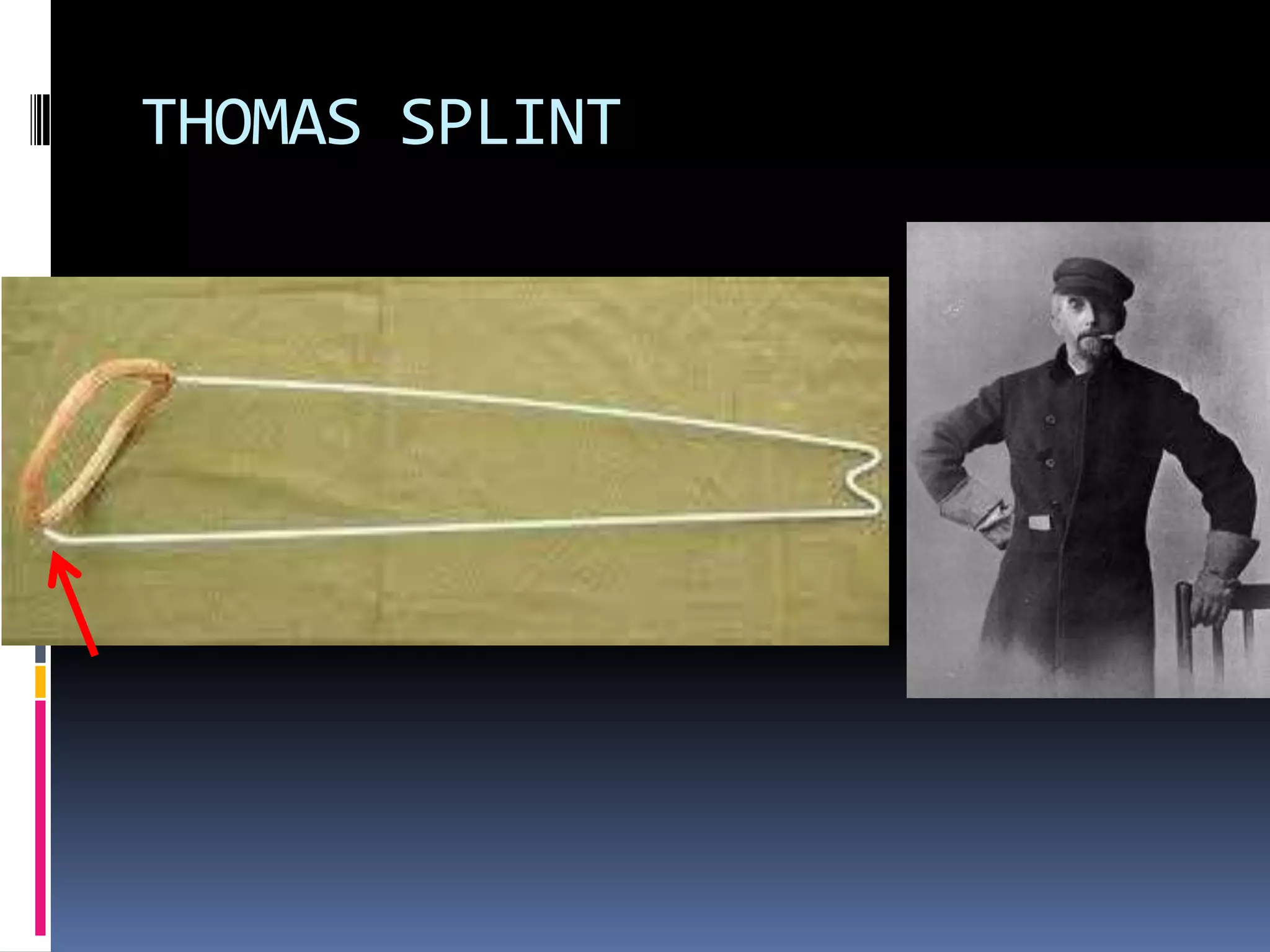 THOMAS SPLINT
 