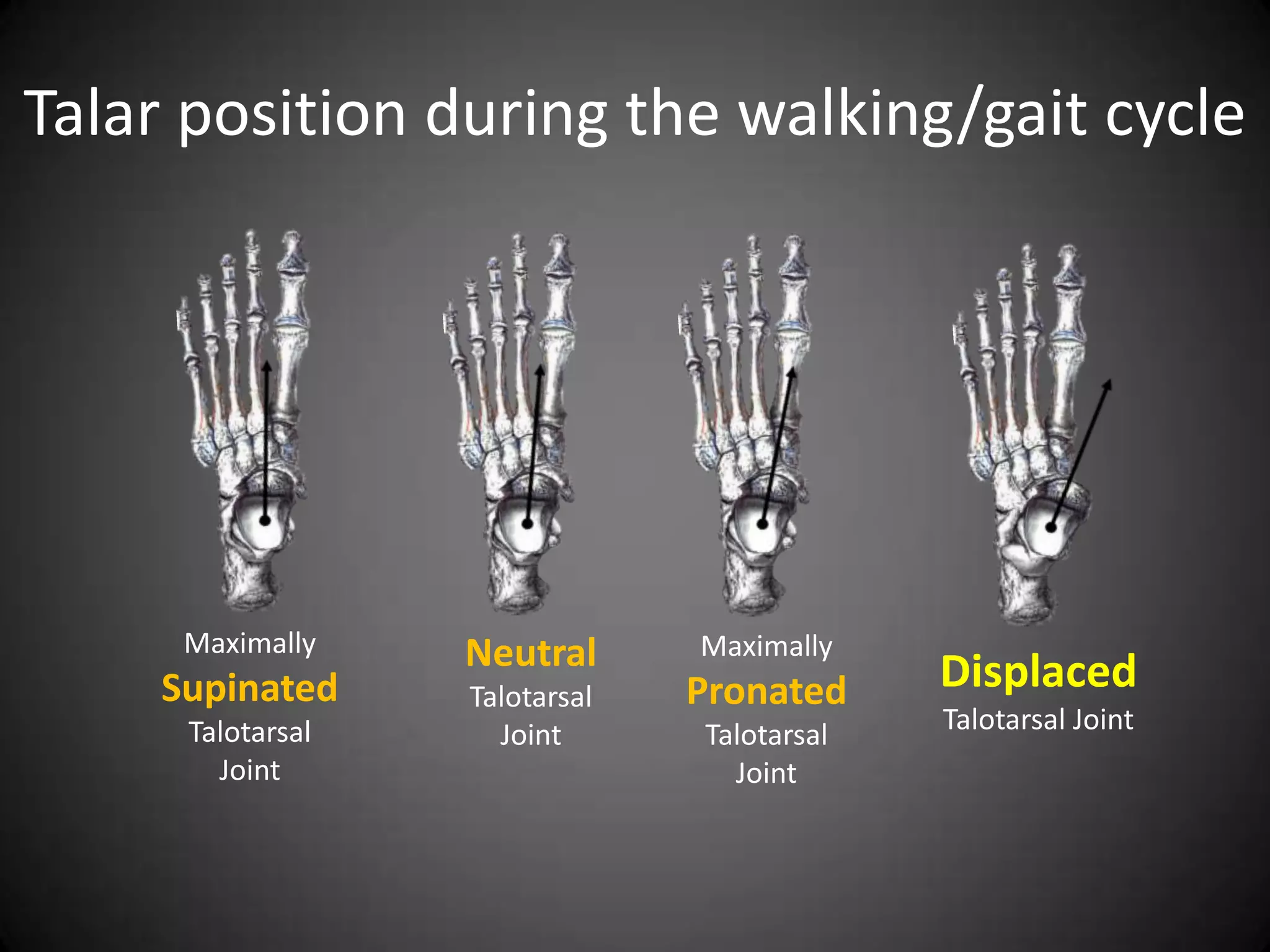 Talar position during the walking/gait cycle




     Maximally    Neutral      Maximally
    Supinated     Talotarsal   Pronated     Displaced
     Talotarsal     Joint      Talotarsal   Talotarsal Joint
       Joint                     Joint
 