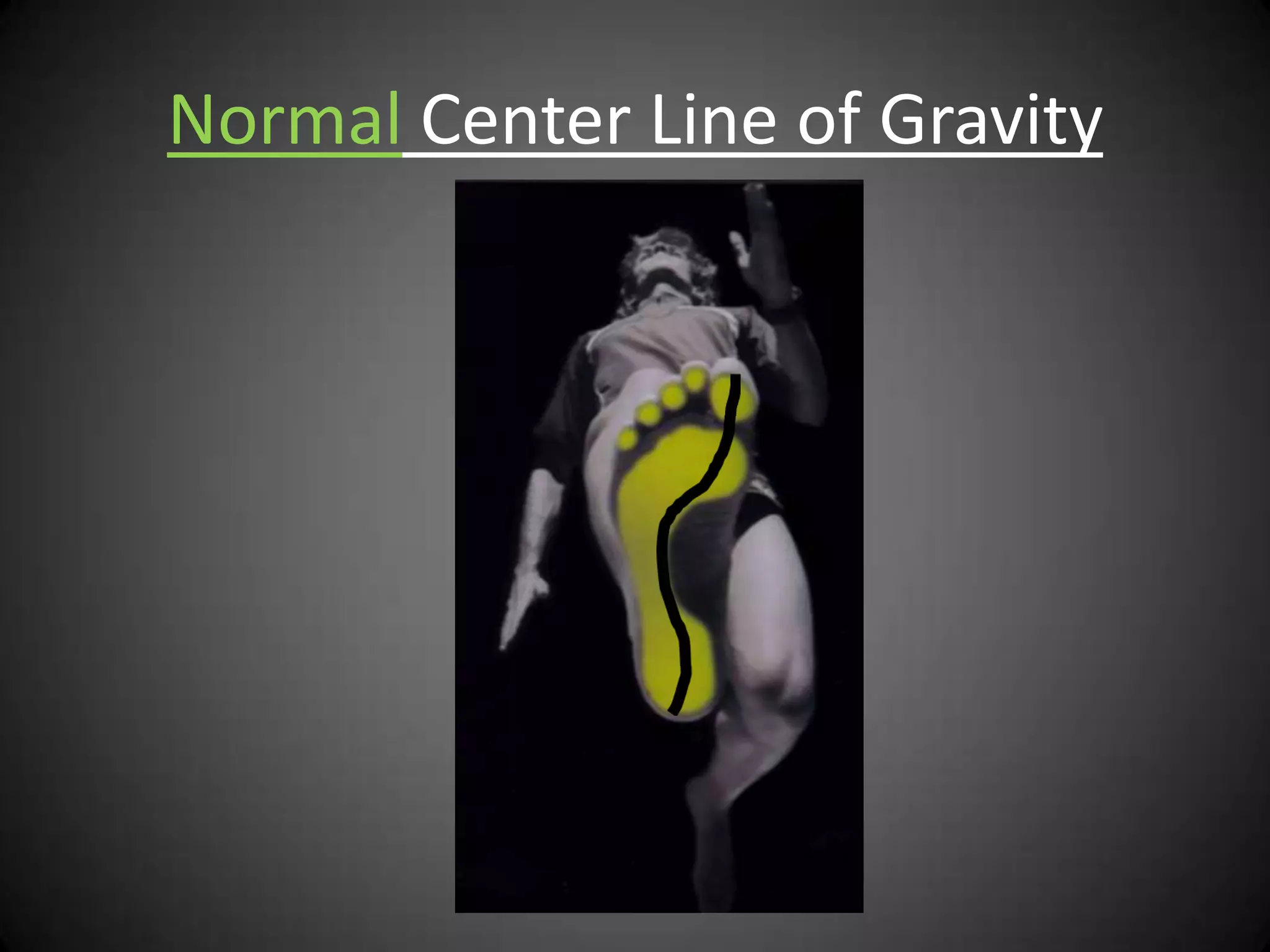 Normal Center Line of Gravity
 