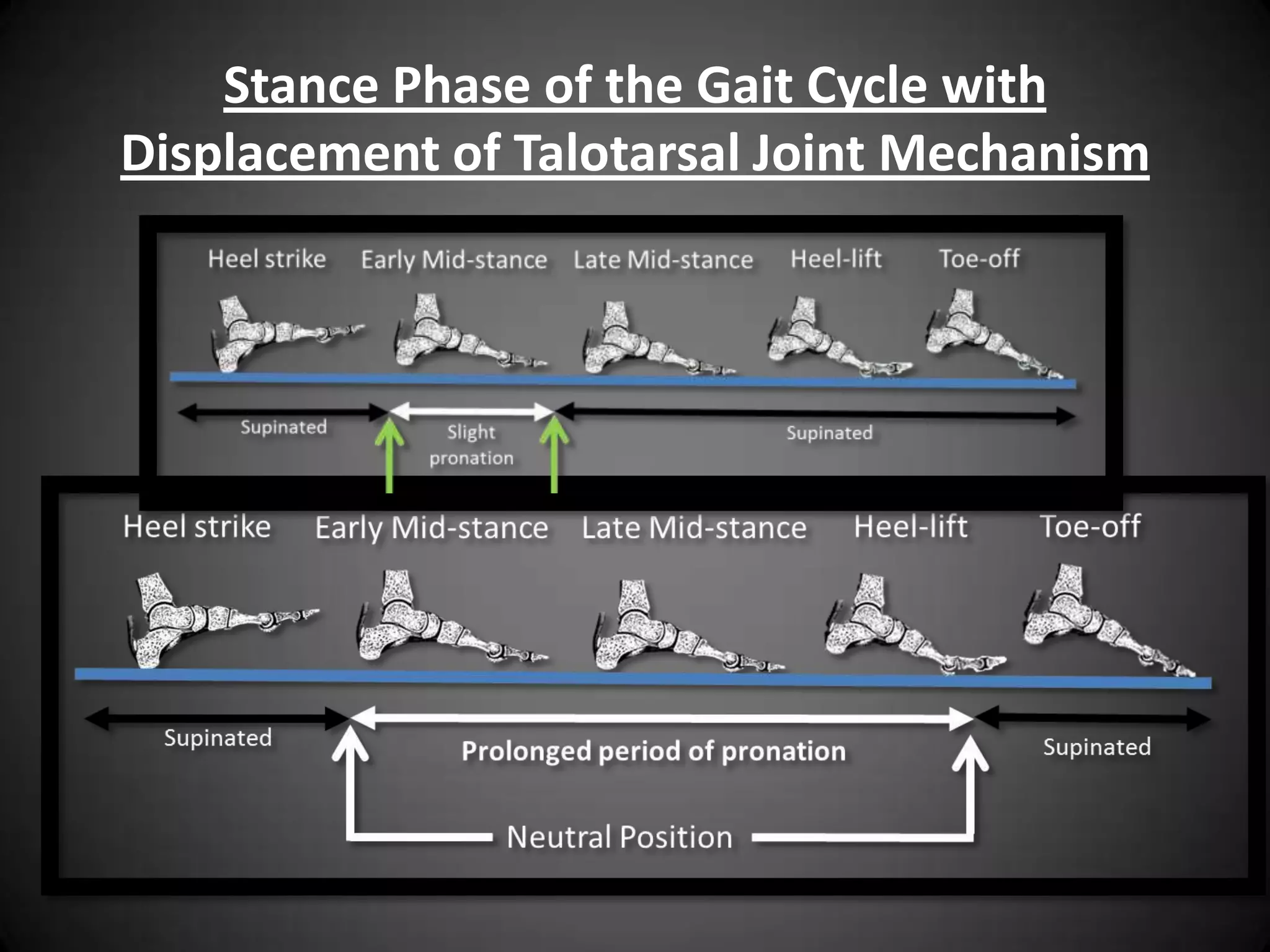 What is the role of an arch
         support?
 