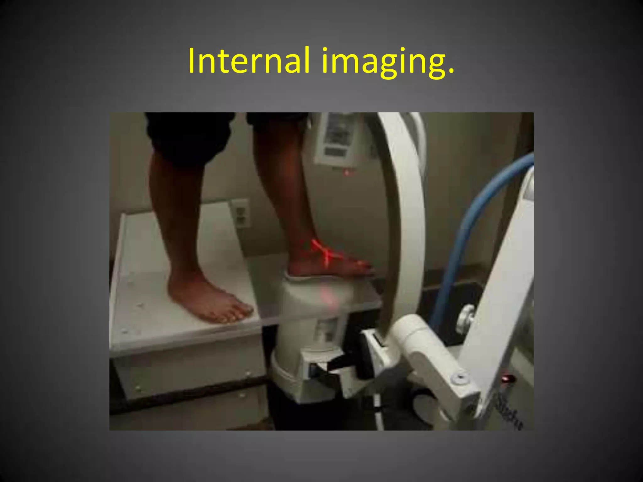 Is this arch support working?
 