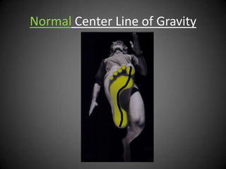 Normal Center Line of Gravity
 
