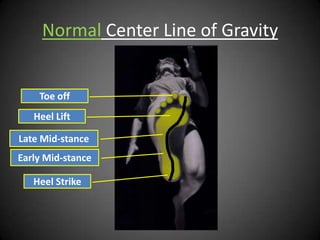 Normal Center Line of Gravity


    Toe off
   Heel Lift

Late Mid-stance
Early Mid-stance

   Heel Strike
 