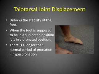 Talotarsal Joint Displacement

• Unlocks the stability of the foot.
• When the foot is supposed to be in a
  supinated position it is in a pronated
  position.
• There is a longer than normal period of
  pronation = hyperpronation
 